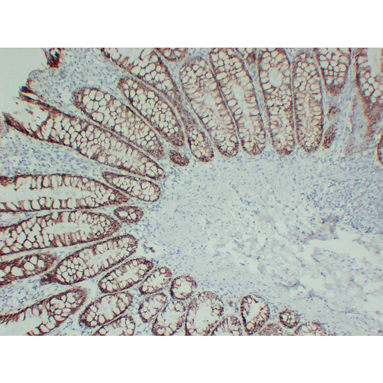 Immunohistochemistry - Anti-TGF beta Receptor I Antibody (V0129) - Antibodies.com