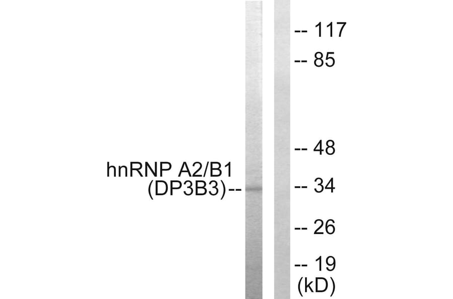 Western Blot - Anti-hnRNP A2 + B1 Antibody (C10452) - Antibodies.com