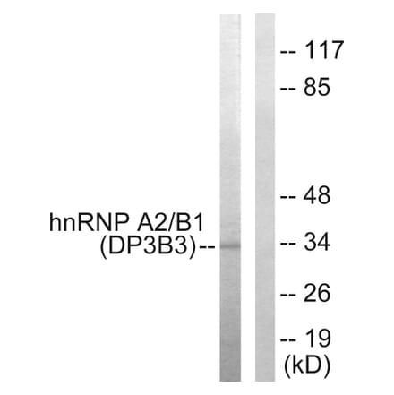Western Blot - Anti-hnRNP A2 + B1 Antibody (C10452) - Antibodies.com