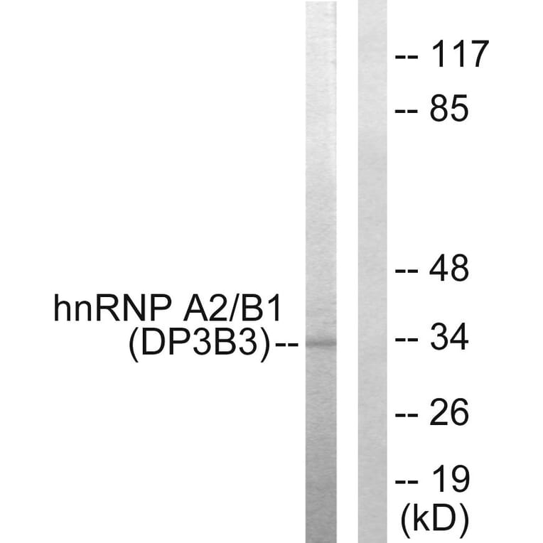 Western Blot - Anti-hnRNP A2 + B1 Antibody (C10452) - Antibodies.com