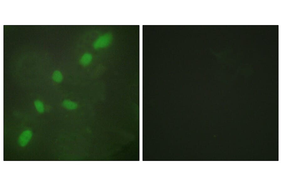 Immunofluorescence - Anti-hnRNP A2 + B1 Antibody (C10452) - Antibodies.com