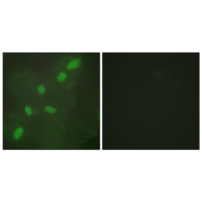Immunofluorescence - Anti-hnRNP A2 + B1 Antibody (C10452) - Antibodies.com