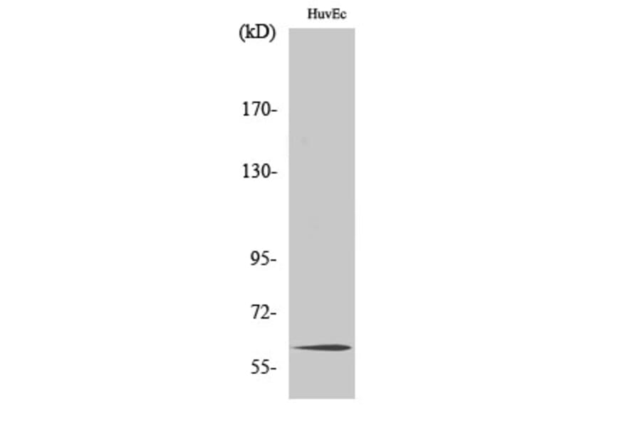 Western Blot - Anti-TCF4 + TCF12 Antibody (C19176) - Antibodies.com