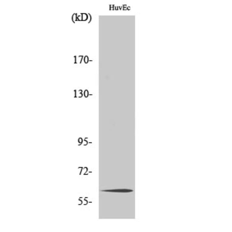 Western Blot - Anti-TCF4 + TCF12 Antibody (C19176) - Antibodies.com