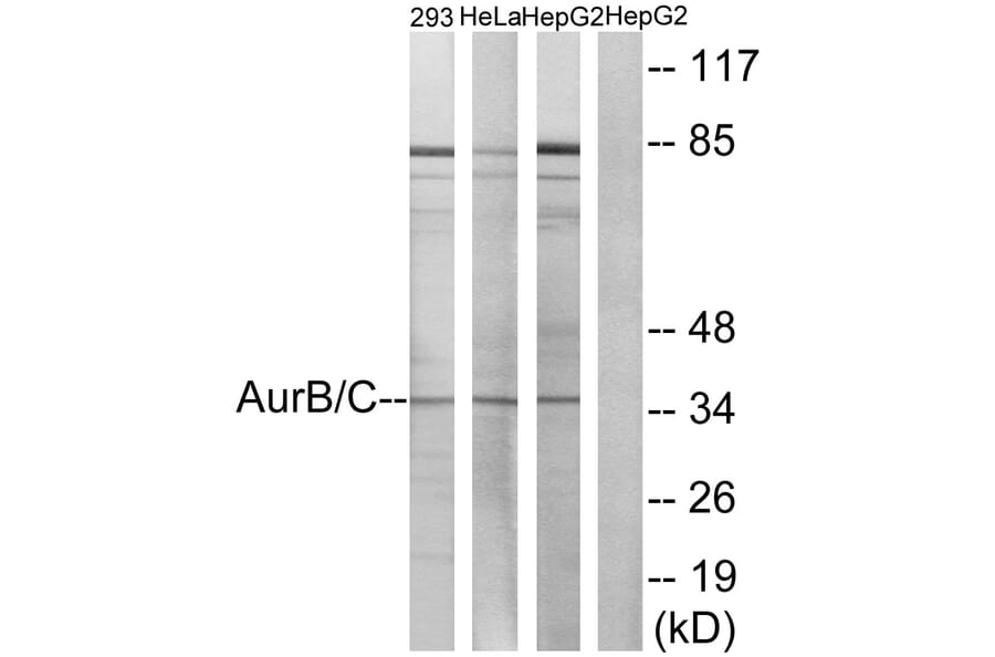 Western Blot - Anti-Aurora B + C Antibody (B1137) - Antibodies.com