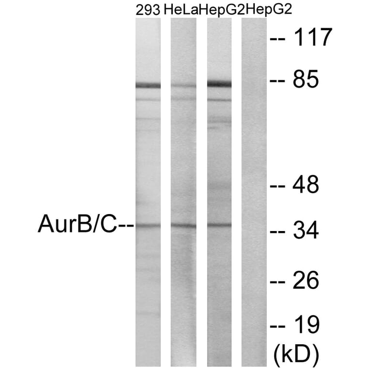 Western Blot - Anti-Aurora B + C Antibody (B1137) - Antibodies.com