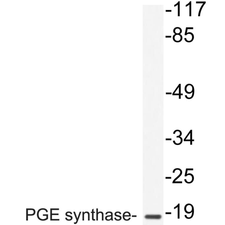 Western Blot - Anti-PGE synthase Antibody (R12-2303) - Antibodies.com