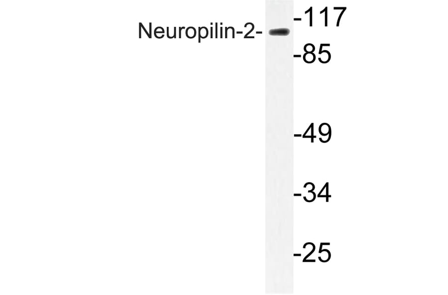 Western Blot - Anti-Neuropilin-2 Antibody (R12-2259) - Antibodies.com