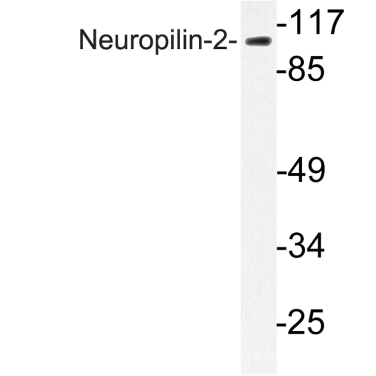 Western Blot - Anti-Neuropilin-2 Antibody (R12-2259) - Antibodies.com