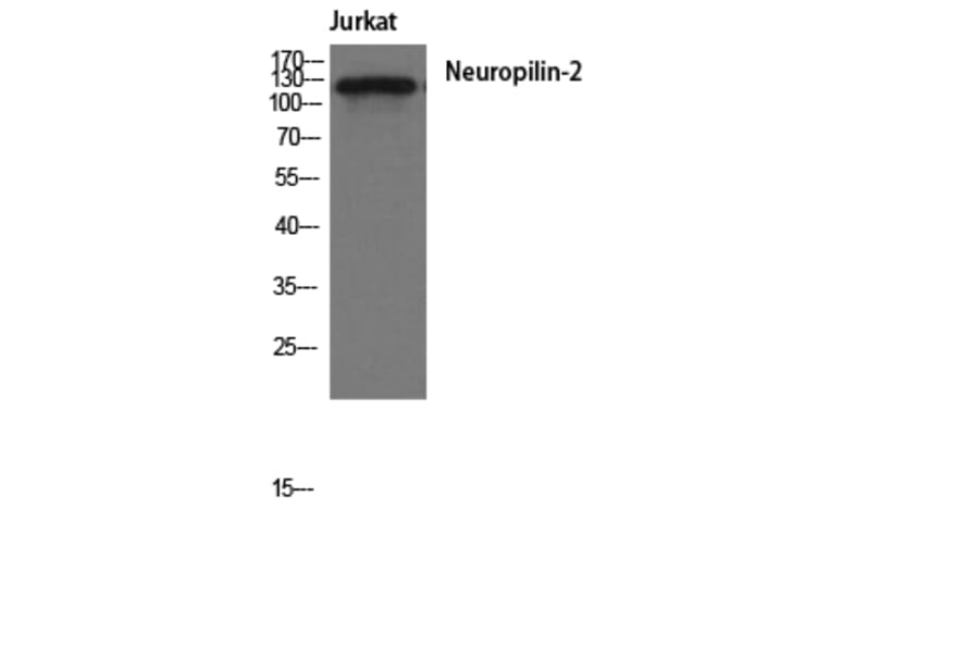 Western Blot - Anti-Neuropilin-2 Antibody (R12-2259) - Antibodies.com