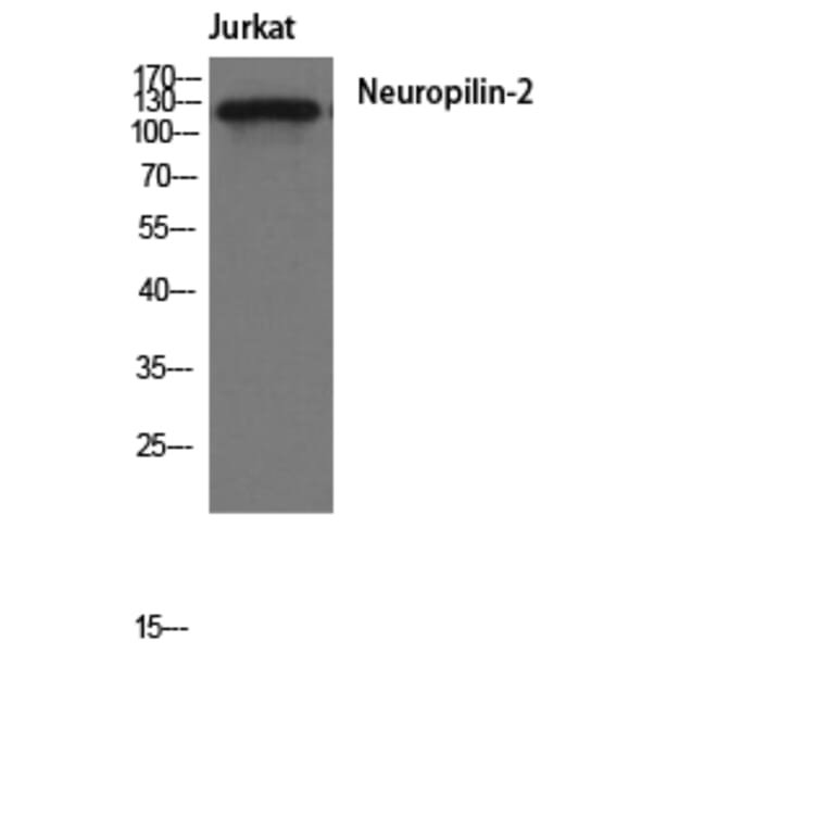 Western Blot - Anti-Neuropilin-2 Antibody (R12-2259) - Antibodies.com