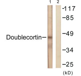 Western Blot - Anti-Doublecortin Antibody (B0637) - Antibodies.com