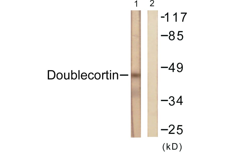 Western Blot - Anti-Doublecortin Antibody (B0637) - Antibodies.com