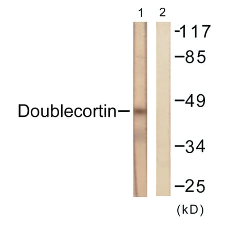 Western Blot - Anti-Doublecortin Antibody (B0637) - Antibodies.com