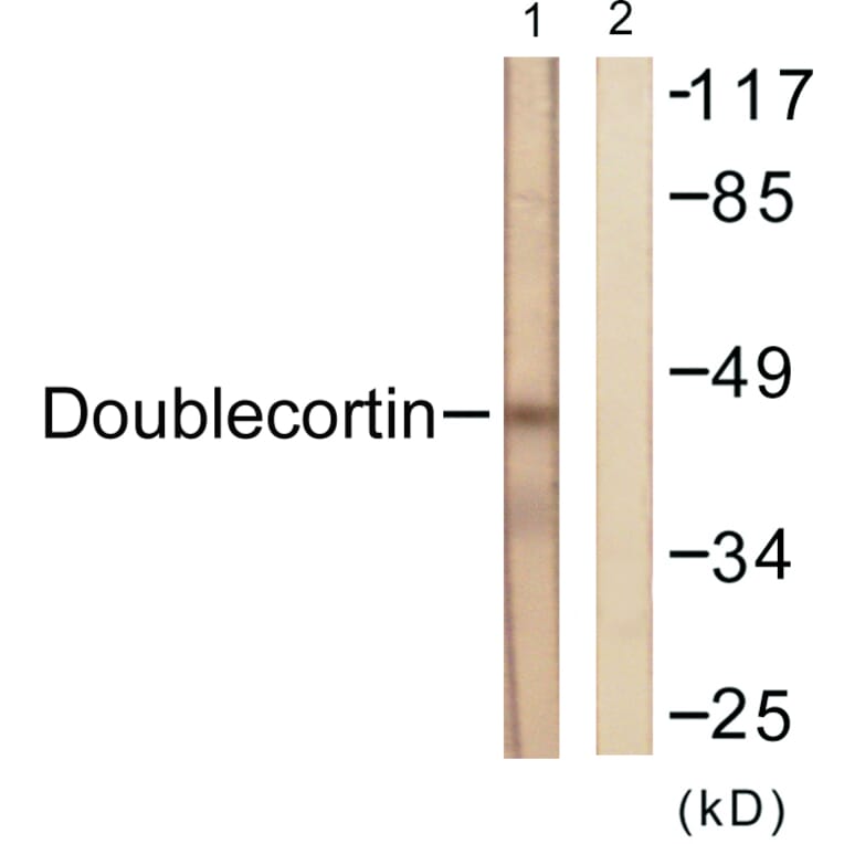 Western Blot - Anti-Doublecortin Antibody (B0637) - Antibodies.com