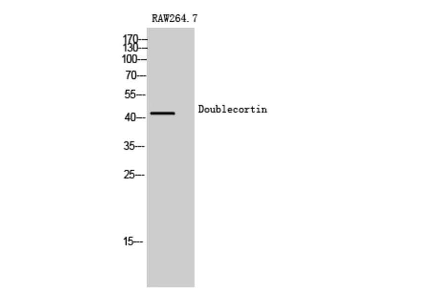 Western Blot - Anti-Doublecortin Antibody (B0637) - Antibodies.com