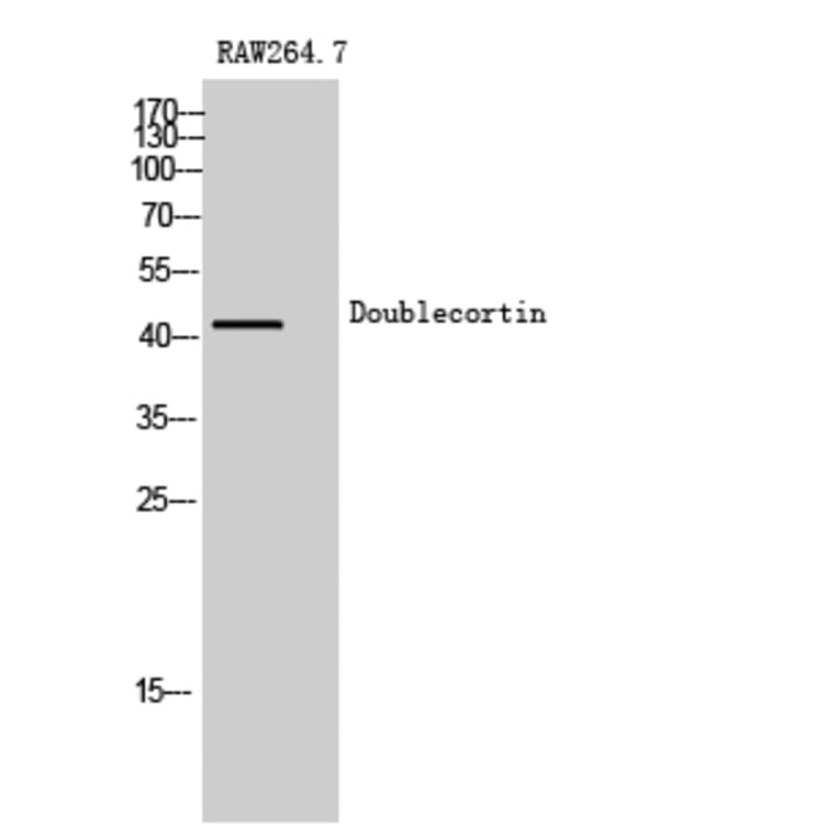 Western Blot - Anti-Doublecortin Antibody (B0637) - Antibodies.com