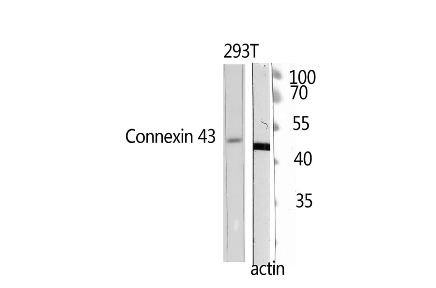 Western Blot - Anti-Doublecortin Antibody (B0637) - Antibodies.com