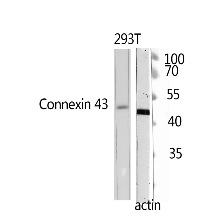 Western Blot - Anti-Doublecortin Antibody (B0637) - Antibodies.com