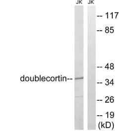Western Blot - Anti-Doublecortin Antibody (B8337) - Antibodies.com