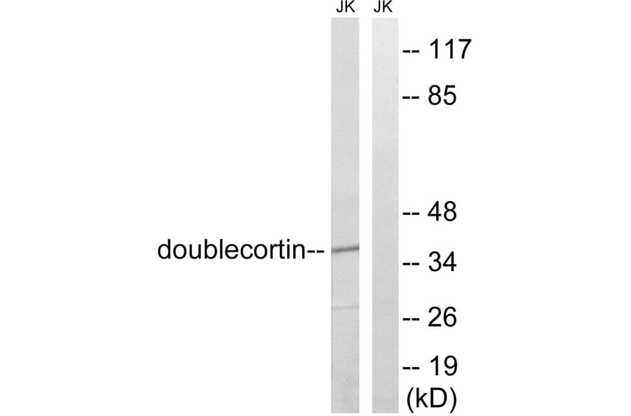 Western Blot - Anti-Doublecortin Antibody (B8337) - Antibodies.com