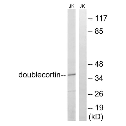 Western Blot - Anti-Doublecortin Antibody (B8337) - Antibodies.com