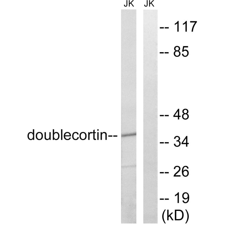 Western Blot - Anti-Doublecortin Antibody (B8337) - Antibodies.com