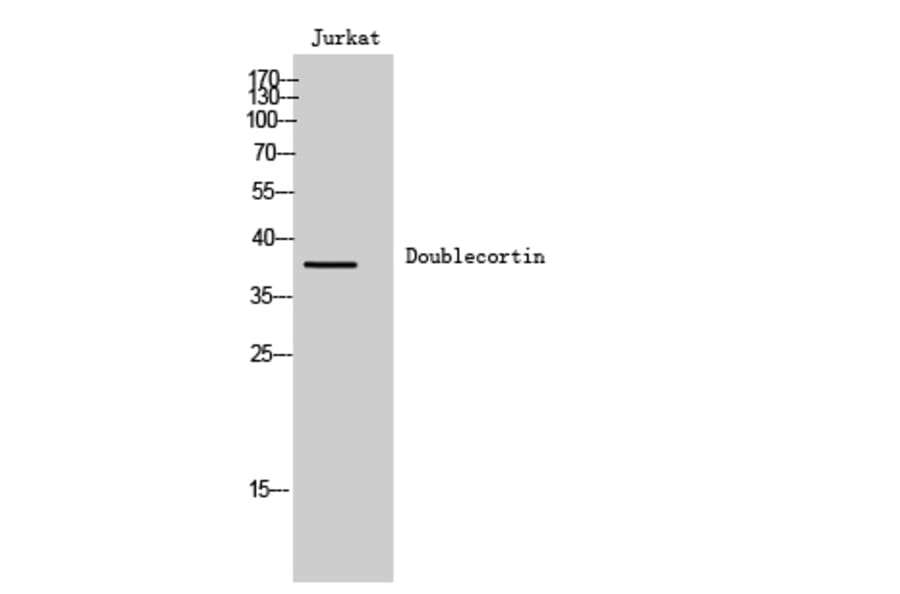 Western Blot - Anti-Doublecortin Antibody (B8337) - Antibodies.com