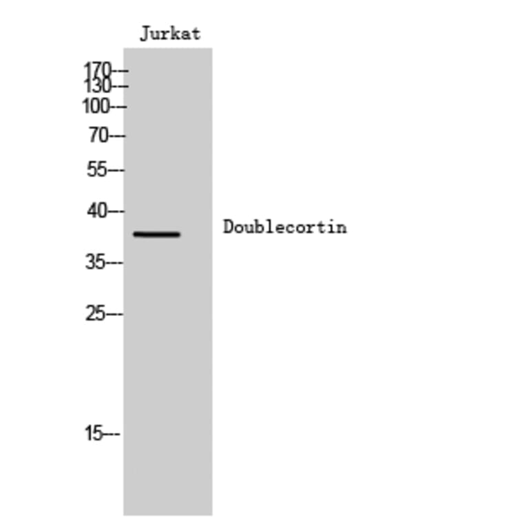 Western Blot - Anti-Doublecortin Antibody (B8337) - Antibodies.com