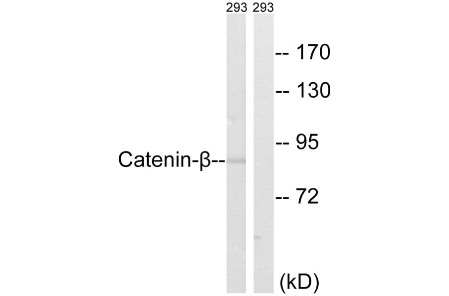 Western Blot - Anti-Catenin-beta Antibody (B8009) - Antibodies.com