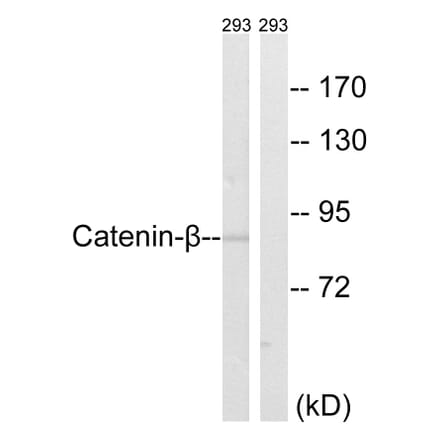 Western Blot - Anti-Catenin-beta Antibody (B8009) - Antibodies.com