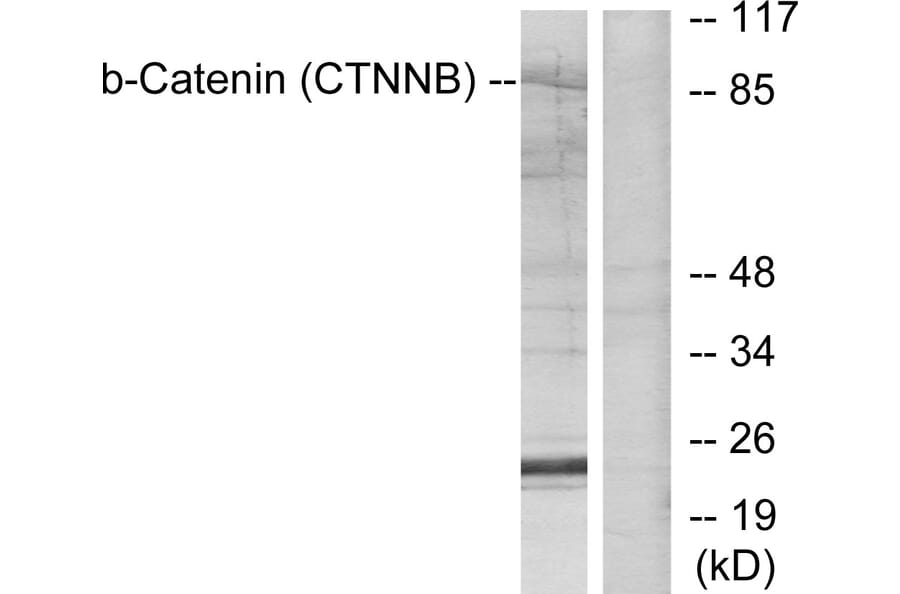 Western Blot - Anti-Catenin-beta Antibody (B7024) - Antibodies.com