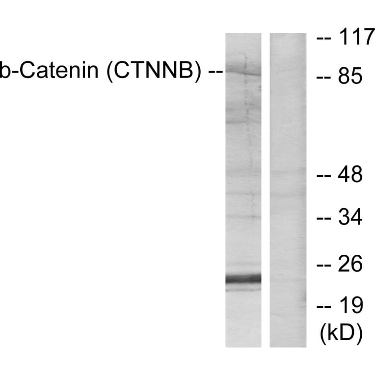Western Blot - Anti-Catenin-beta Antibody (B7024) - Antibodies.com