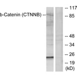 Western Blot - Anti-Catenin-beta Antibody (B7024) - Antibodies.com