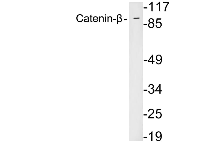Western Blot - Anti-Catenin-beta Antibody (R12-2056) - Antibodies.com