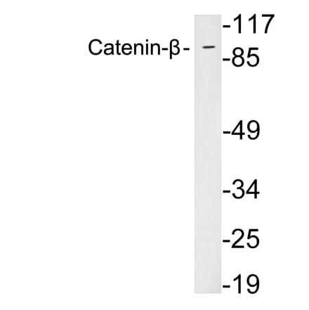 Western Blot - Anti-Catenin-beta Antibody (R12-2056) - Antibodies.com