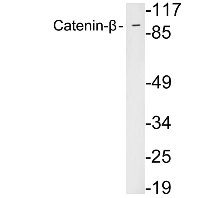 Western Blot - Anti-Catenin-beta Antibody (R12-2056) - Antibodies.com