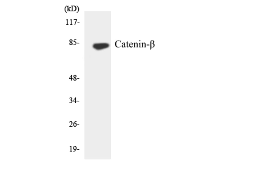 Western Blot - Anti-Catenin-beta Antibody (R12-2571) - Antibodies.com