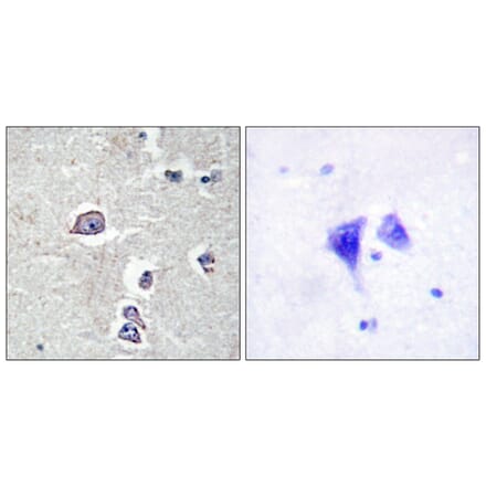 Immunohistochemistry - Anti-PDGFR alpha Antibody (B0969) - Antibodies.com