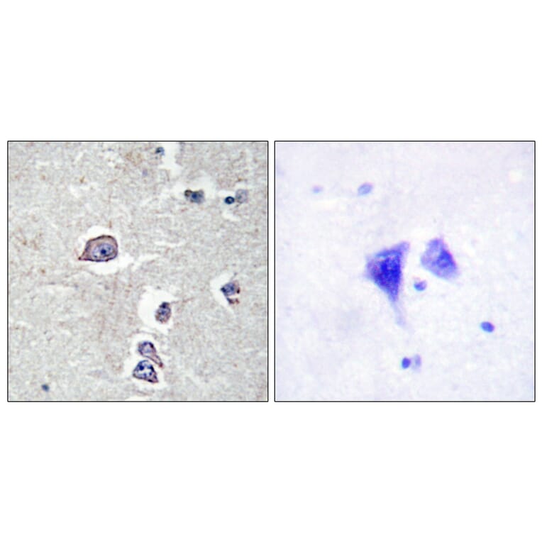 Immunohistochemistry - Anti-PDGFR alpha Antibody (B0969) - Antibodies.com