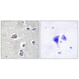 Immunohistochemistry - Anti-PDGFR alpha Antibody (B0969) - Antibodies.com