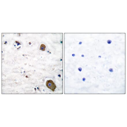 Immunohistochemistry - Anti-GFR alpha-1 Antibody (C0200) - Antibodies.com