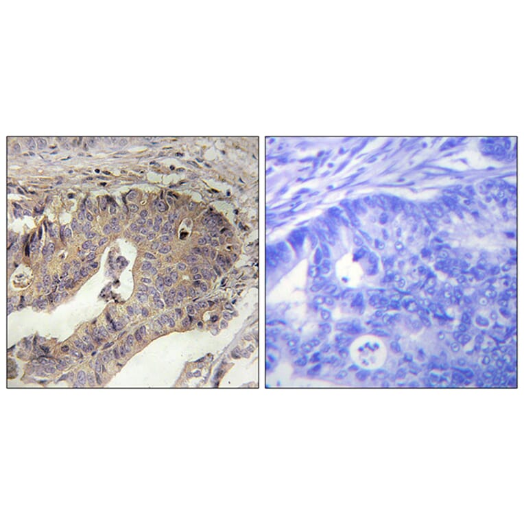 Immunohistochemistry - Anti-Fibrillin-1 Antibody (C0194) - Antibodies.com