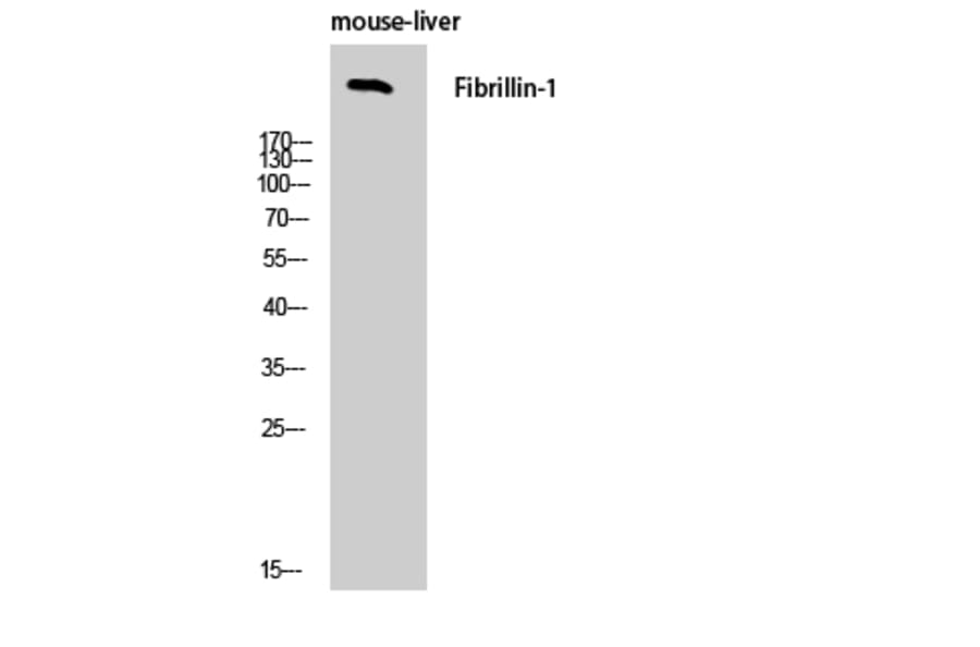 Western Blot - Anti-Fibrillin-1 Antibody (C0194) - Antibodies.com