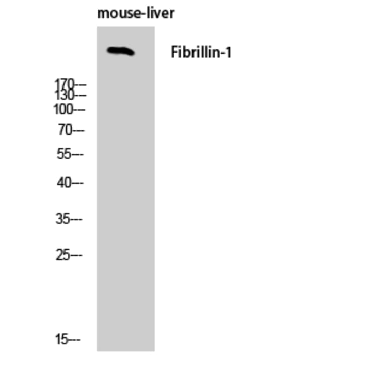 Western Blot - Anti-Fibrillin-1 Antibody (C0194) - Antibodies.com