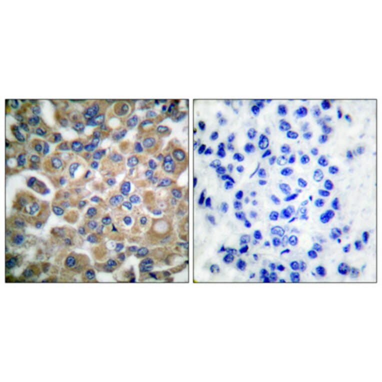 Immunohistochemistry - Anti-Fibrillin-1 Antibody (C0194) - Antibodies.com