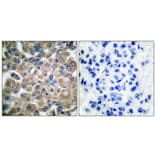 Immunohistochemistry - Anti-Fibrillin-1 Antibody (C0194) - Antibodies.com