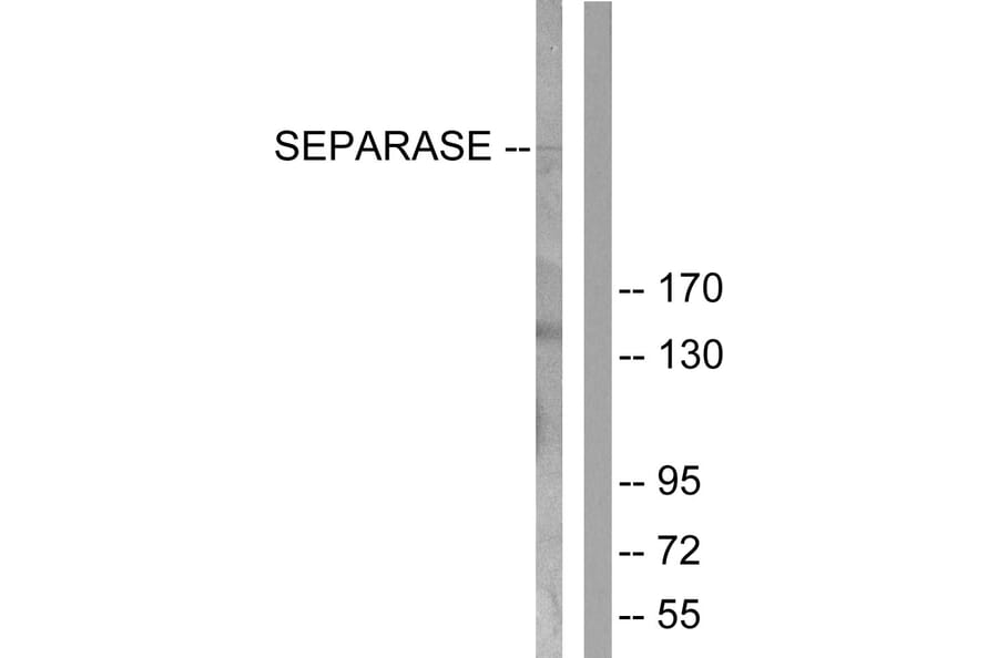 Western Blot - Anti-SEPARASE Antibody (B0086) - Antibodies.com
