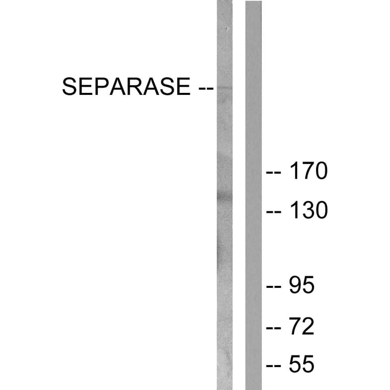 Western Blot - Anti-SEPARASE Antibody (B0086) - Antibodies.com