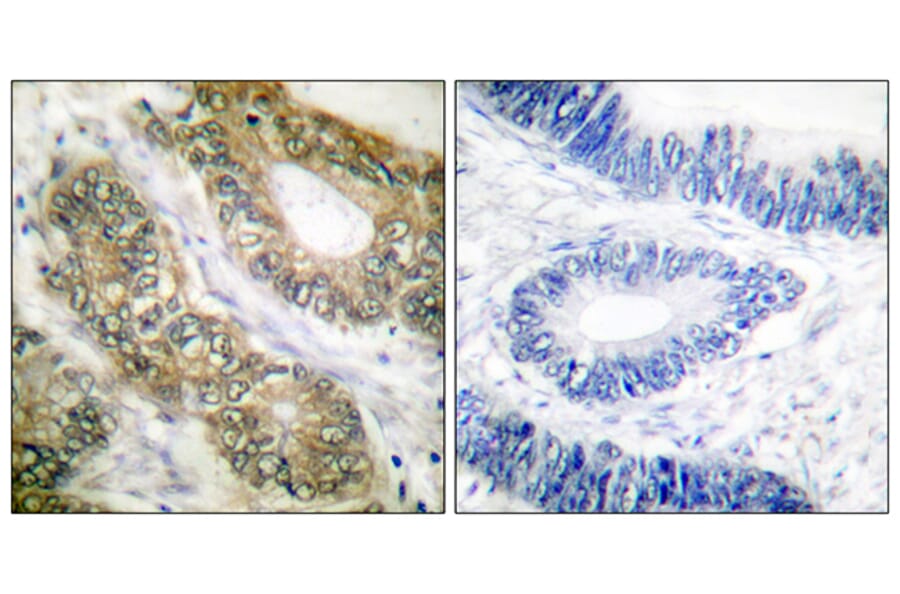 Immunohistochemistry - Anti-SEPARASE Antibody (B0086) - Antibodies.com